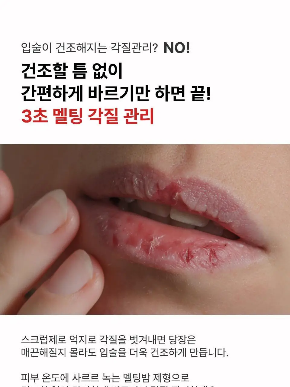 [컬러립밤] 아이소이 립 트리트먼트 밤 5g 5종 상세페이지 22